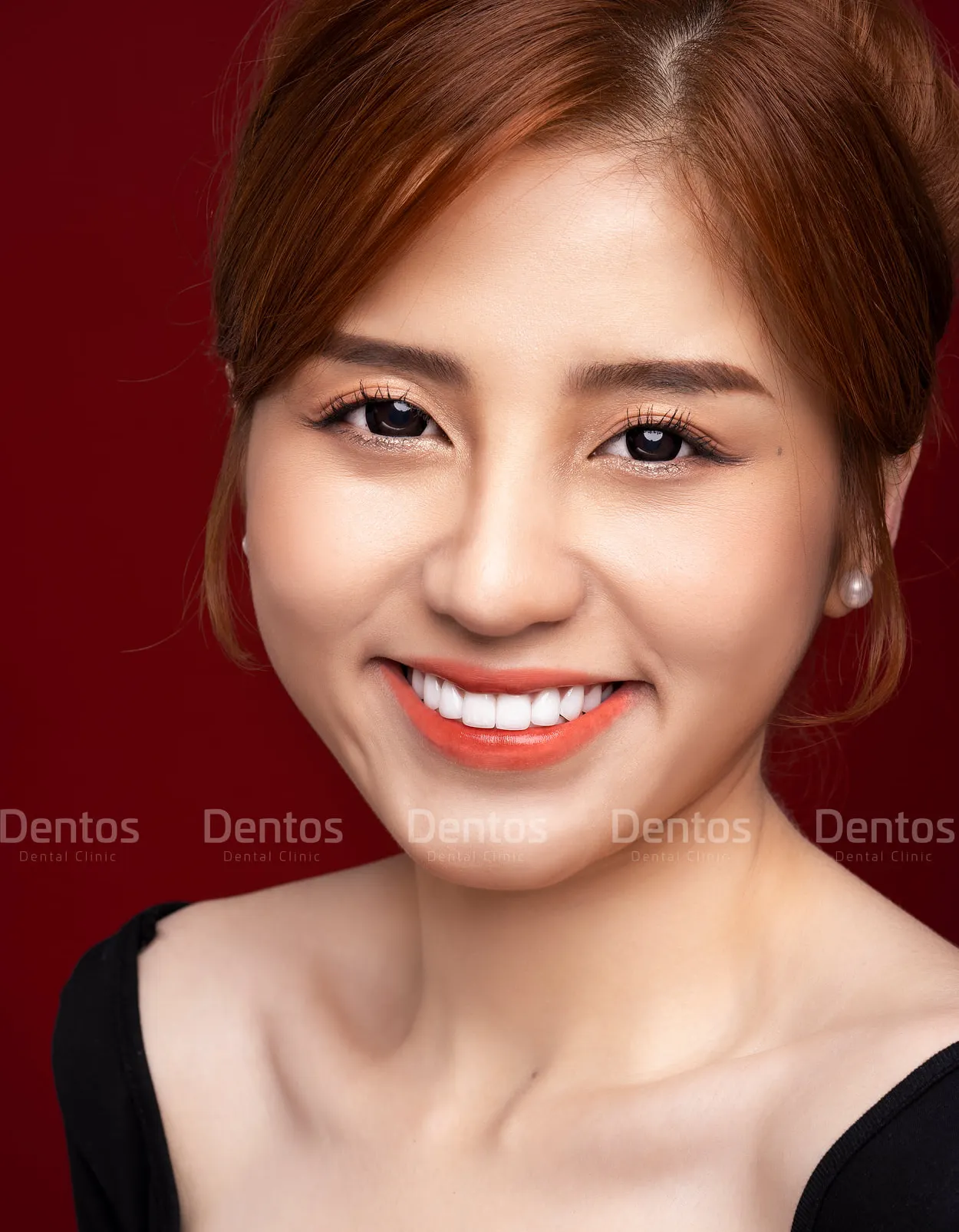 Nha khoa Dentos - địa chỉ bọc răng sứ không mài uy tín tại TPHCM